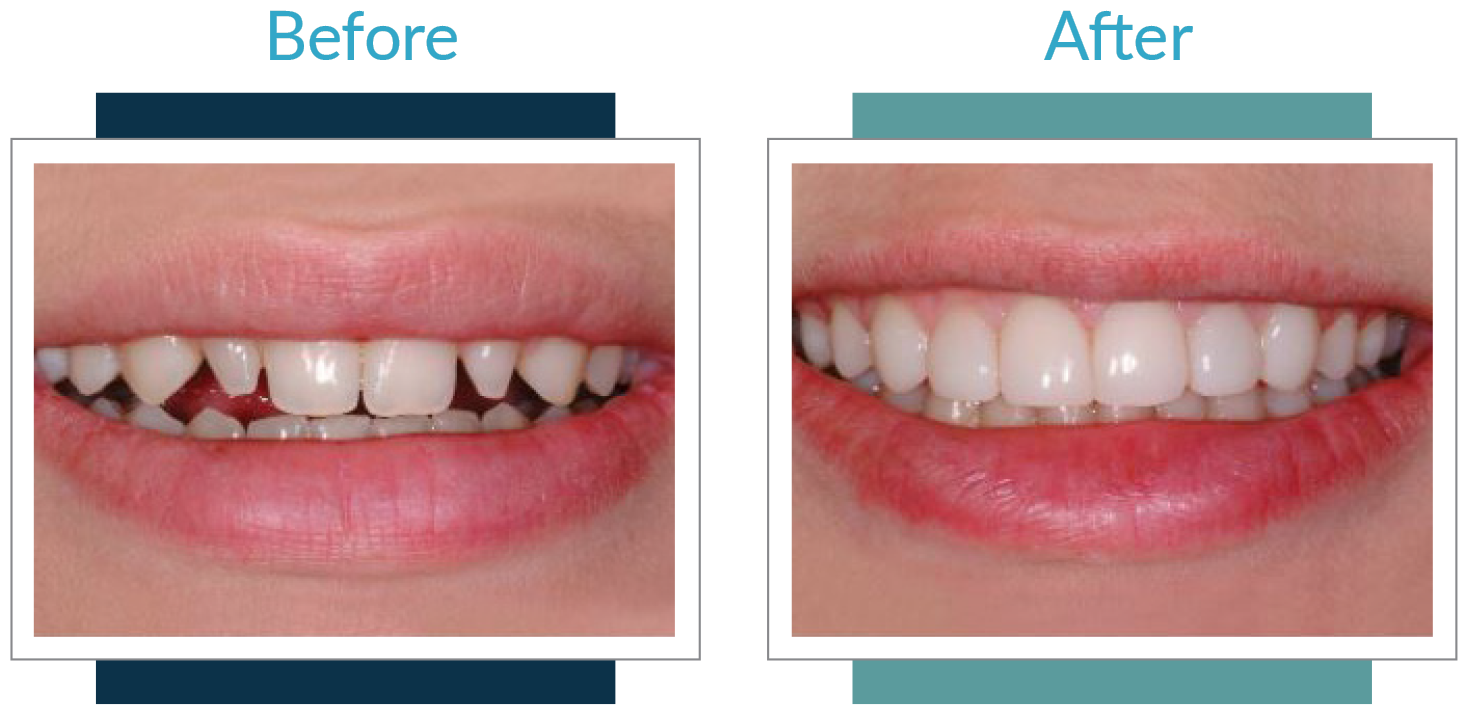 Best Dentists in Iowa Before and After 2